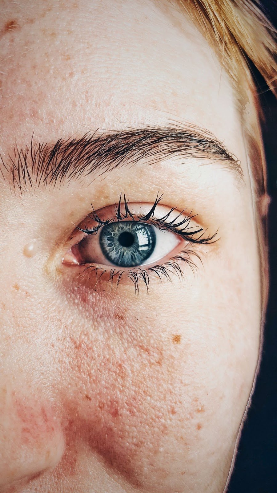 Sensitive Skin Face Close Up