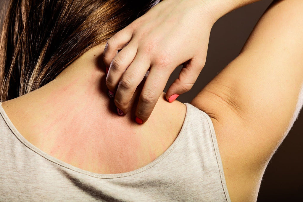 Dermatitis Self-care Woman Scratching